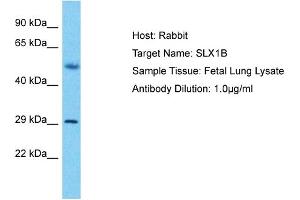 Host: Rabbit Target Name: SLX1B Sample Type: Fetal Lung lysates Antibody Dilution: 1.