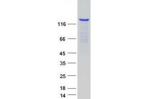 Western Blotting (WB) image for Lysine (K)-Specific Demethylase 4A (KDM4A) protein (Myc-DYKDDDDK Tag) (ABIN2723930)