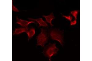ABIN6275598 staining COLO205 by IF/ICC. (SLCO1B1 Antikörper)