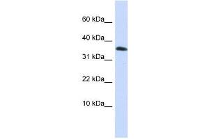 Western Blot showing EMX1 antibody used at a concentration of 1-2 ug/ml to detect its target protein. (EMX1 Antikörper  (Middle Region))