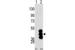 Western Blotting (WB) image for anti-phosphorylase Kinase, gamma 2 (Testis) (PHKG2) antibody (ABIN3003064) (PHKG2 Antikörper)