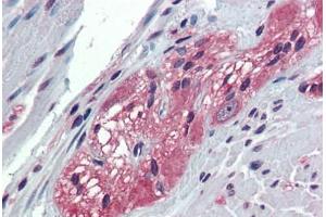 Anti-TXLNB antibody  ABIN1049448 IHC staining of human colon, ganglion cells. (Taxilin beta Antikörper  (Internal Region))