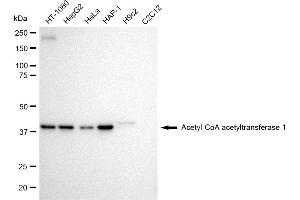 Western blotting analysis using Acetyl-CoA acetyltransferase 1 antibody (ABIN7797439). (Rekombinanter ACAT1 Antikörper)