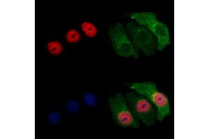 ABIN7094046 and ABIN7098090 staining Hela cells by IF/ICC. (ZNF238 Antikörper  (Internal Region))