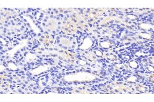 Detection of MFN1 in Human Kidney Tissue using Polyclonal Antibody to Mitofusin 1 (MFN1) (MFN1 Antikörper  (AA 1-227))