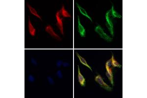 CRISP3 Antibody staining Hela cells by IF/ICC. (CRISP3 Antikörper  (Internal Region))
