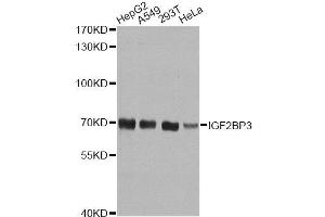 Western blot analysis of extracts of various cell lines, using IGF2BP3 antibody. (IGF2BP3 Antikörper  (AA 300-579))