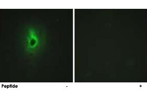 Immunofluorescence analysis of HeLa cells, using COL6A3 polyclonal antibody . (COL6a3 Antikörper  (AA 2261-2310))