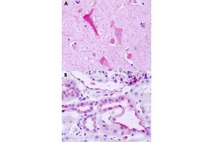 Immunohistochemical staining of formalin-fixed paraffin-embedded human brain, neurons (A) and human kidney (B) with GPR137B polyclonal antibody . (GPR137B Antikörper  (C-Term))