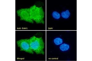 Immunofluorescence (IF) image for anti-E3 Ubiquitin-Protein Ligase SIAH1 (SIAH1) (N-Term) antibody (ABIN184675)