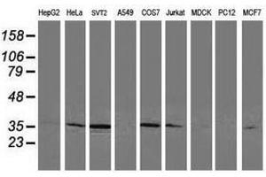 Image no. 2 for anti-Cyclin-Dependent Kinase 2 (CDK2) antibody (ABIN1497399) (CDK2 Antikörper)