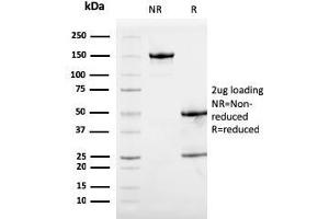 SDS-PAGE Analysis Purified Calprotectin Mouse Monoclonal Antibody (S100A9/1075).