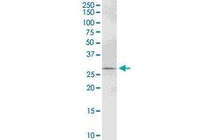 PYCR1 MaxPab polyclonal antibody. (PYCR1 Antikörper  (AA 1-319))