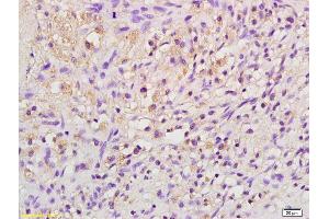 Formalin-fixed and paraffin embedded rat kidney labeled with Anti-EPO Polyclonal Antibody, Unconjugated (ABIN679718) at 1:200 followed by conjugation to the secondary antibody and DAB staining (EPO Antikörper  (AA 101-193))