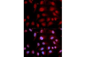 Immunofluorescence analysis of U2OS cell using POLB antibody. (POLB Antikörper  (AA 1-335))