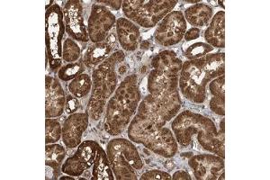 Immunohistochemical staining (Formalin-fixed paraffin-embedded sections) of human kidney shows strong cytoplasmic positivity in tubular cells. (PAX3 and PAX7 Binding Protein 1 (PAXBP1) Antikörper)