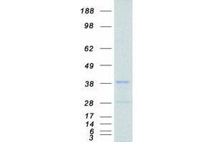 Western Blotting (WB) image for Protein Kinase, Interferon-Inducible Double Stranded RNA Dependent Activator (PRKRA) (Transcript Variant 1) protein (Myc-DYKDDDDK Tag) (ABIN2729646)