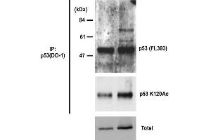 Western Blotting (WB) image for anti-Tumor Protein P53 (TP53) (acLys315) antibody (ABIN3201007) (p53 Antikörper  (acLys315))
