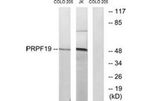 Western blot analysis of extracts from COLO/Jurkat cells, using PRPF19 Antibody. (PRP19 Antikörper  (AA 171-220))