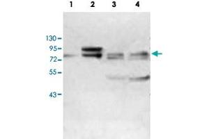 Western blot analysis of human fetal kidney (Lane 1) and MCF-7 cell (Lane 2), K-562 cell (Lane 3) and HeLa cell (Lane 4) lysates with ABCF3 polyclonal antibody  at 1 : 500 dilution. (ABCF3 Antikörper  (AA 442-681))