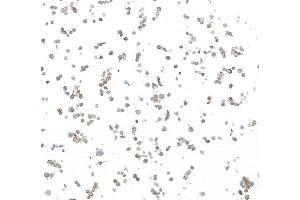 Immunocytochemistry (ICC) image for anti-Epidermal Growth Factor Receptor (EGFR) (C-Term) antibody (ABIN7795642) (Rekombinanter EGFR Antikörper  (C-Term))