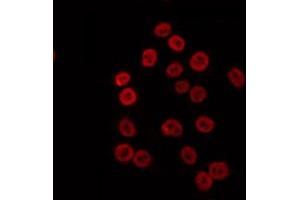 ABIN6274692 staining K562 by IF/ICC. (MLH1 Antikörper  (Internal Region))