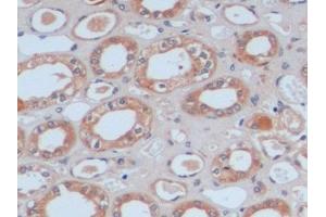 Detection of FN in Human Kidney Tissue using Polyclonal Antibody to Fibronectin (FN) (Fibronectin Antikörper  (AA 1998-2106))