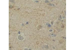 Used in DAB staining on fromalin fixed paraffin- embedded Kidney tissue (NRN1 Antikörper  (AA 28-142))