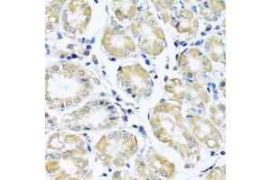 Immunohistochemistry of paraffin-embedded human stomach using NDUFB10 antibody.