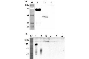 Western blot analysis of human DLK1 using anti-DLK1 (human), pAb  at 1: 2,000 dilution. (DLK1 Antikörper  (Extracellular Domain))