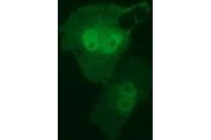 Anti-RIT2 mouse monoclonal antibody (ABIN2453598) immunofluorescent staining of COS7 cells transiently transfected by pCMV6-ENTRY RIT2 (RC205367).