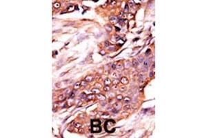 Immunohistochemistry (Paraffin-embedded Sections) (IHC (p)) image for anti-Activin Receptor Type I (ACRV1) (AA 6-34), (N-Term) antibody (ABIN391155)