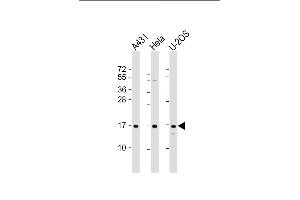 All lanes : Anti-RPLP1 Antibody (N-Term) at 1:2000 dilution Lane 1: A431 whole cell lysate Lane 2: Hela whole cell lysate Lane 3: U-2OS whole cell lysate Lysates/proteins at 20 μg per lane. (RPLP1 Antikörper  (AA 18-49))
