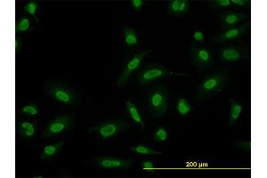Immunofluorescence of monoclonal antibody to SMAD5 on HeLa cell.