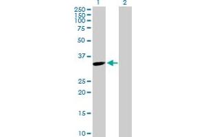 Western Blot analysis of TYMS expression in transfected 293T cell line by TYMS MaxPab polyclonal antibody. (TYMS Antikörper  (AA 1-313))