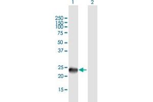 Western Blot analysis of SSX9 expression in transfected 293T cell line by SSX9 MaxPab polyclonal antibody. (SSX9 Antikörper  (AA 1-188))