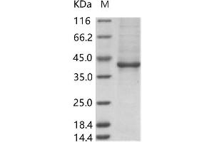 Western Blotting (WB) image for Zika Virus Envelope (ZIKV E) protein (Fc Tag) (ABIN7198749) (ZIKV E Protein (Fc Tag))