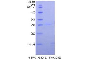 SDS-PAGE analysis of Rat GATA Binding Protein 4 Protein.