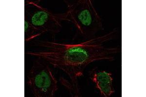 Immunofluorescence analysis of NTERA-2 cells using SIRT1 mouse mAb (green). (SIRT1 Antikörper)
