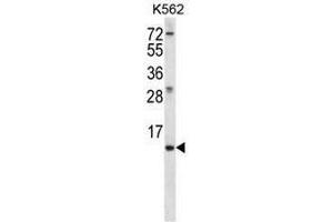MEIG1 Antibody (Center) western blot analysis in K562 cell line lysates (35µg/lane). (MEIG1 Antikörper  (Middle Region))