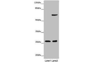 Western blot All lanes: SOX14 antibody at 14 μg/mL Lane 1: Human placenta tissue Lane 2: HepG2 whole cell lysate Secondary Goat polyclonal to rabbit IgG at 1/10000 dilution Predicted band size: 27 kDa Observed band size: 27 kDa (SOX14 Antikörper  (AA 1-137))