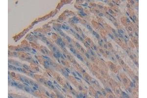 Detection of TMEM27 in Mouse Stomach Tissue using Polyclonal Antibody to Transmembrane Protein 27 (TMEM27) (TMEM27 Antikörper  (AA 12-222))