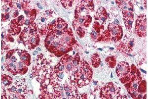 Human Adrenal (formalin-fixed, paraffin-embedded) stained with HSPD1 antibody ABIN462102 at 10 ug/ml followed by biotinylated anti-mouse IgG secondary antibody ABIN481714, alkaline phosphatase-streptavidin and chromogen. (HSPD1 Antikörper)