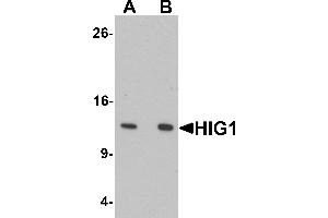 Western blot analysis of HIG1 in 293 cell lysate with HIG1 antibody at at (A) 0. (HIGD1A Antikörper  (N-Term))