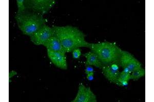 Anti-DPP4 mouse monoclonal antibody (ABIN2452961) immunofluorescent staining of COS7 cells transiently transfected by pCMV6-ENTRY DPP4 (RC209466). (DPP4 Antikörper)