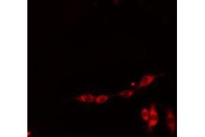 ABIN6278629 staining HepG2 cells by IF/ICC. (RIOK3 Antikörper  (Internal Region))