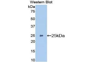 Detection of Recombinant GSTp, Mouse using Polyclonal Antibody to Glutathione S Transferase Pi (GSTp) (GSTP1 Antikörper  (AA 1-210))