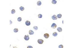 Immunocytochemistry of TSC2 in L1210 cells with this product at 10 μg/ml. (Tuberin Antikörper  (N-Term))