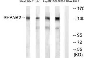 Western blot analysis of extracts from RAW264. (SHANK2 Antikörper  (AA 331-380))