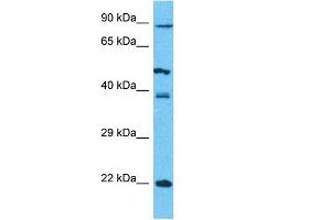 Host:  Rabbit  Target Name:  PCDHB5  Sample Type:  293T Whole Cell lysates  Antibody Dilution:  1.
